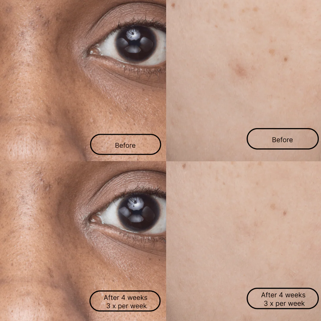 Loops Hyper Smooth Single Mask